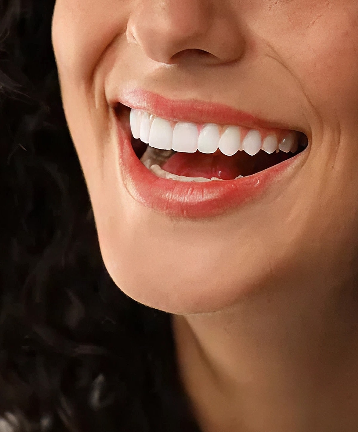 Smiling person showcasing bright, white teeth.