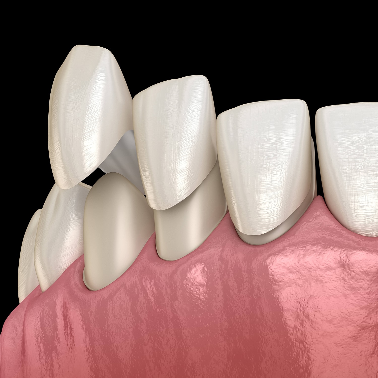 3D rendering of human teeth and gums.