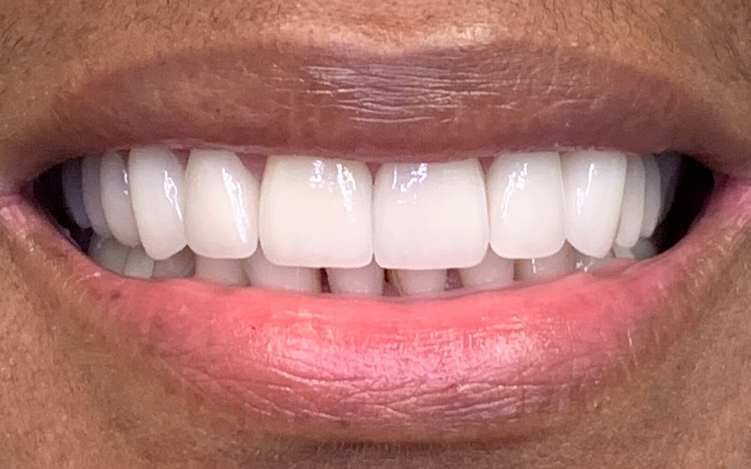 Multidisciplinary Dentistry Before & After