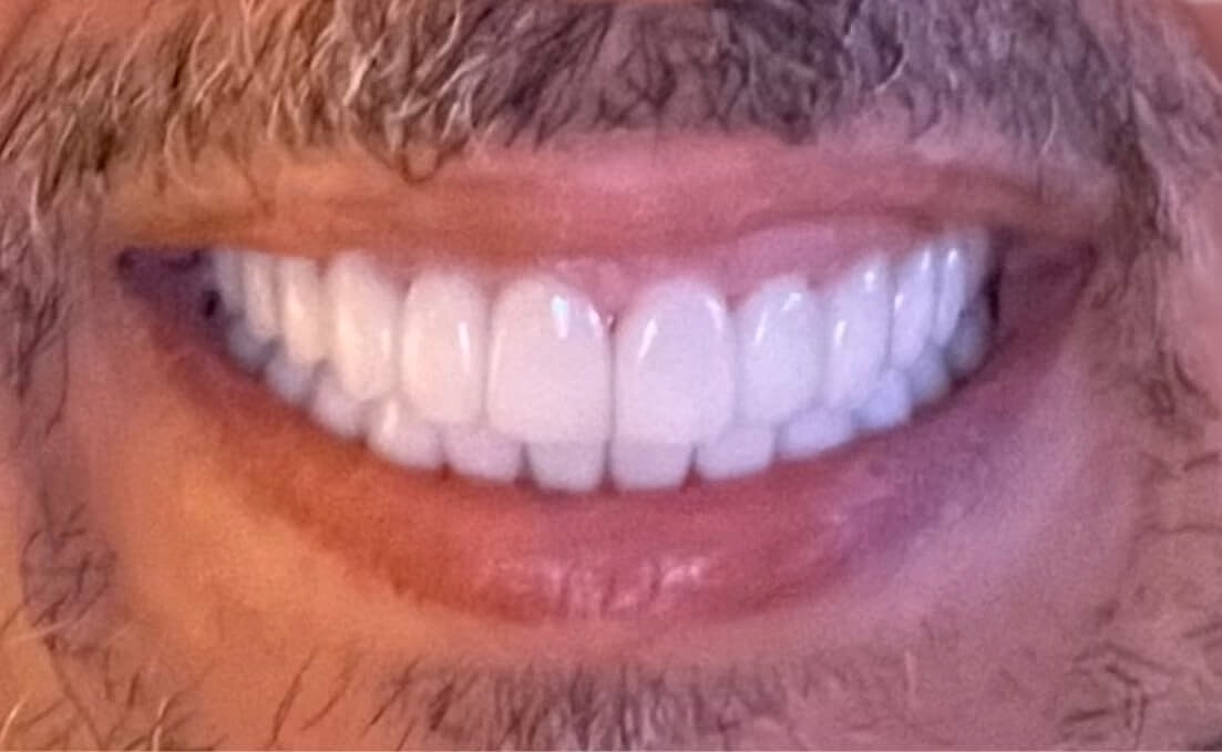 Multidisciplinary Dentistry Before & After