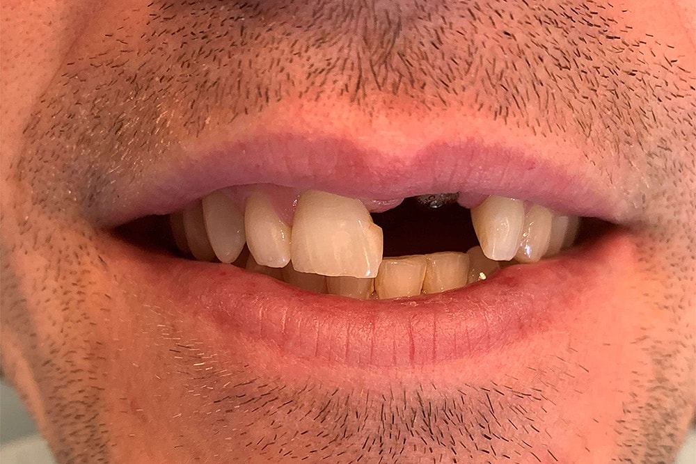 Trauma Treatment Before & After